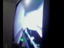 Massive Seizures Massive Seizures
