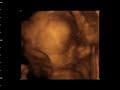 MICAH ALLANA 27 WEEKS 4D9