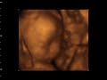 MICAH ALLANA 27 WEEKS 4D9