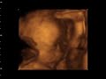 MICAH ALLANA 27 WEEKS 4D9