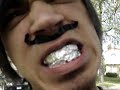 Thumbnail #1