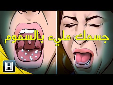 سبعة أعراض تخبرك بأن جسمك مليء بالسموم