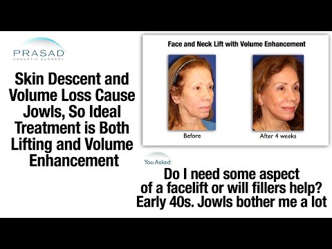 how to treat jowls