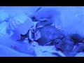 Twins Birth