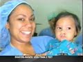 Cleft Lift Surgery - http://www.westernreserve.us Cleft Lift Surgery - http://www.westernreserve.us