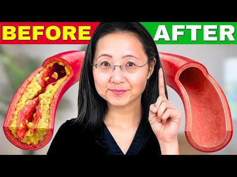 How to Unclog Arteries Naturally.
