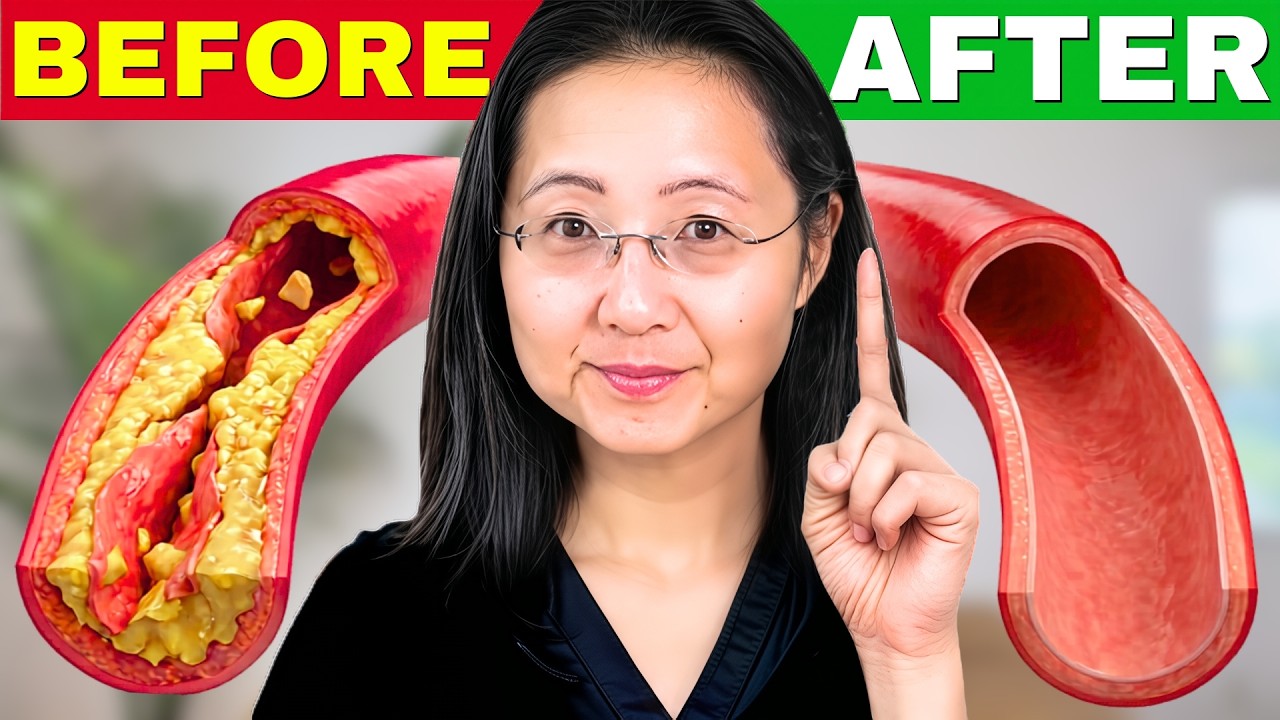 How to Unclog Arteries Naturally.