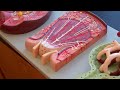 Urinary System Anatomy model walk through for A&P2 with Dr. Waits