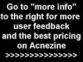 Does Acnezine Really Work?
