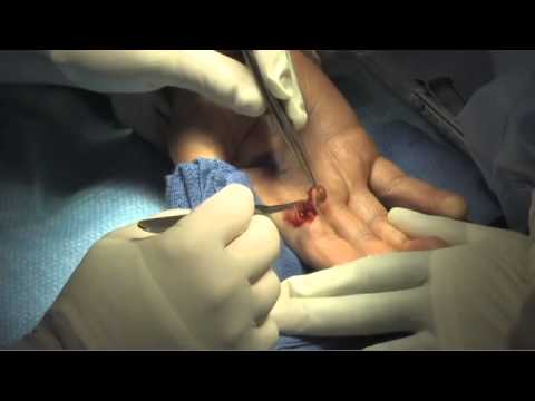 how to eliminate pyrogens