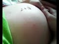 Baby Moving Inside Tummy