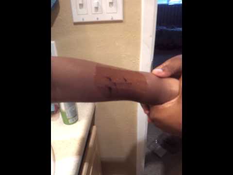 how to remove sharpie from skin