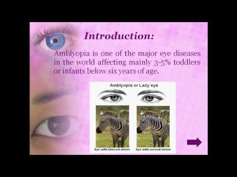 how to cure amblyopia