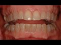 KESSLER DENTISTRY MOVIE