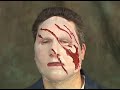 Thumbnail #3
