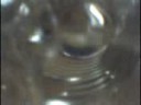 S�ndrome Aleatorio