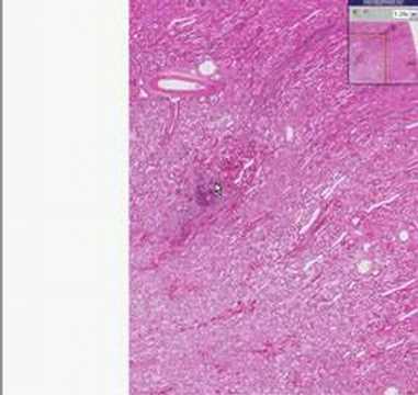 Histopathology Kidney--Bacterial ...