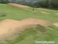 Girl Gets Hit By RC Car