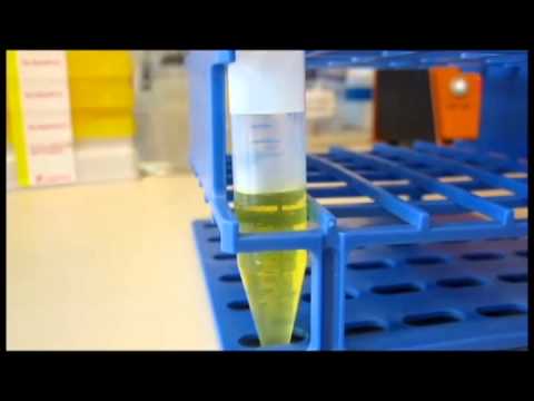 how to isolate dna from agarose gel