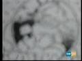 Assistir ao v�deo