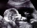 Fetal Development Week 17 (Pregnancy Health Guru)