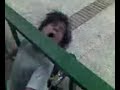 ostion niño bici  = dientes rotos  camara lenta 
