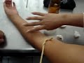 Sacando sangre CUCS Jonathan Sacando sangre CUCS Jonathan