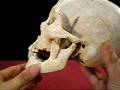 videos de Human Skull - Large Male - with Dental Anomaly MD-07