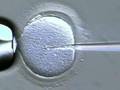 Intracytoplasmic Sperm Injection (ICSI) - Atlanta Georgia