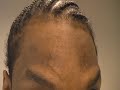 The Acne Practice (Dark Marks and Acne 3) The Acne Practice (Dark Marks and Acne 3)