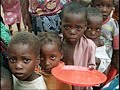 Fome no mundo