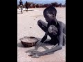 Fome no mundo