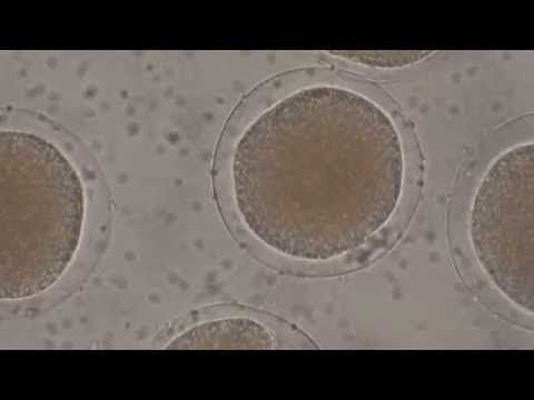 how to fertilize egg and sperm