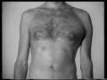 videos de arrhythmie, 1999 - (chapter I)
