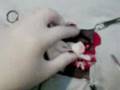 Ablacion de tumor en la piel - video #1