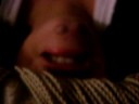 my chin face