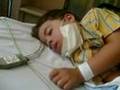 Zachary Lumbar Puncture with intrathecal chemo