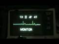 Vital Ethics ACLS ECG Recognition Sacramento