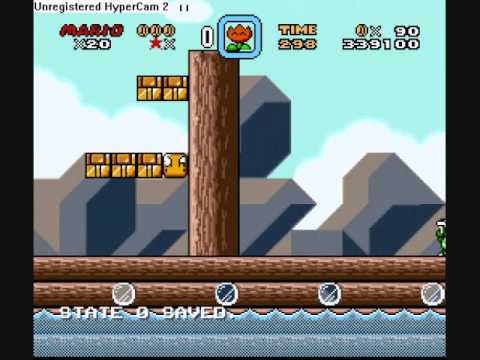 Immagine anteprima YouTube