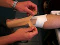 Achilles Tape application Achilles Tape application