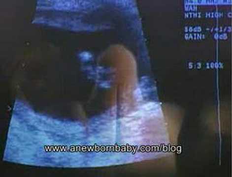 how to care in pregnancy in 4th month