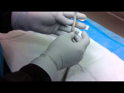 how to obtain umbilical cord blood gas