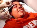LA SUTURA DEL WEy DE DANIEL