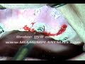 Comprehensive Implant Dentistry Live Training Courses at MiamiImplantsLive.com