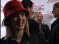 Arden Myrin and Her Burn Marks