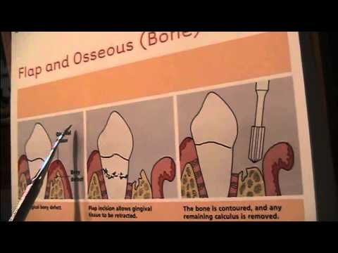 how to treat gum infection