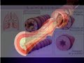 Full Flex - Asma - Pediatria