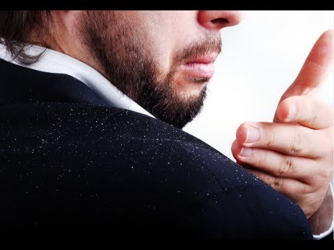 how to cure excessive dandruff