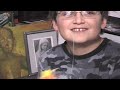 Nerf Gun Tooth Extraction Nerf Gun Tooth Extraction