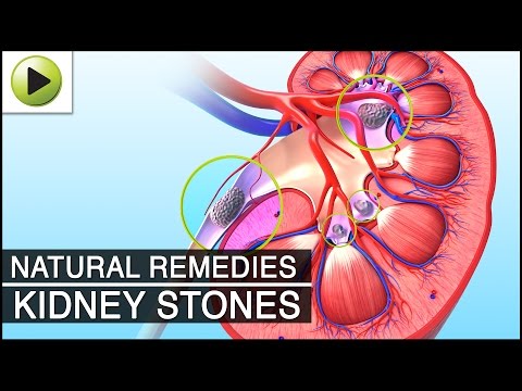 how to help kidney stone pain
